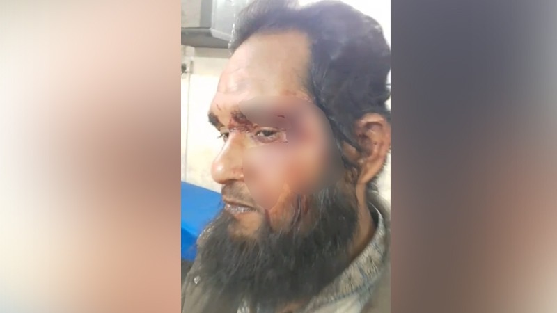 এএসআইয়ের বিরুদ্ধে চাচাতো ভাইকে পিটিয়ে আহত করার অভিযোগ