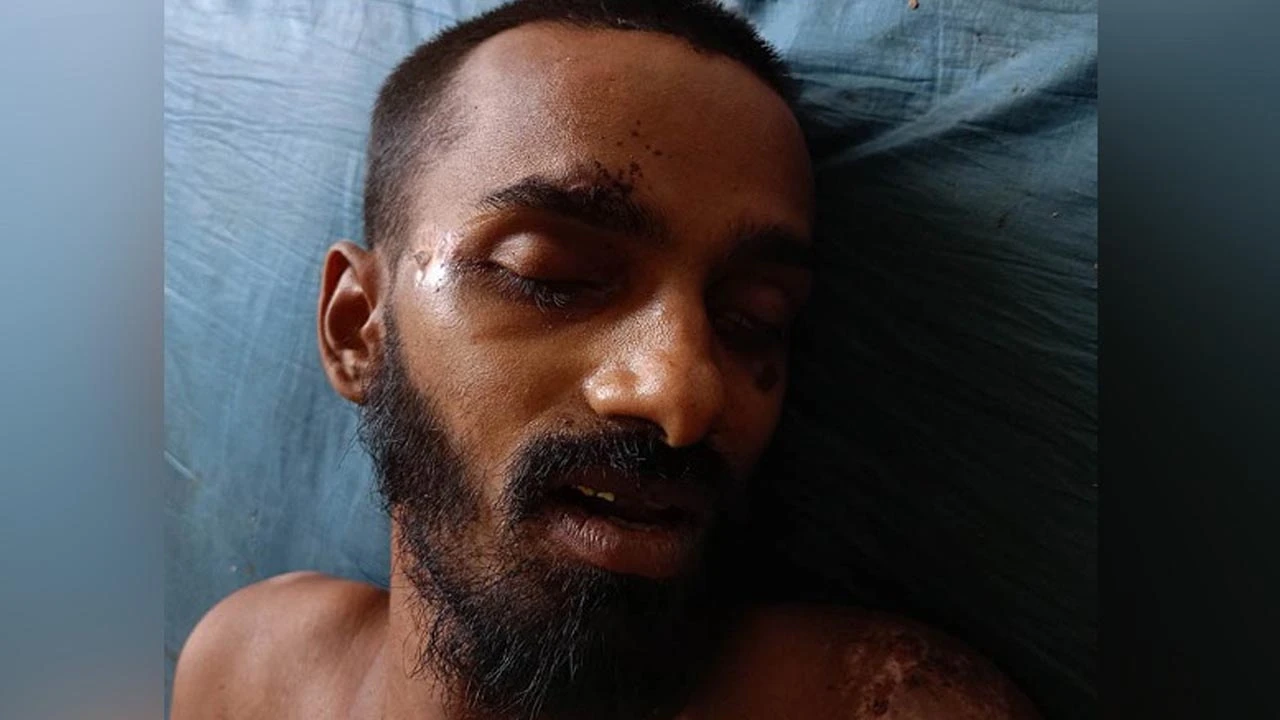 কে এই রোগী